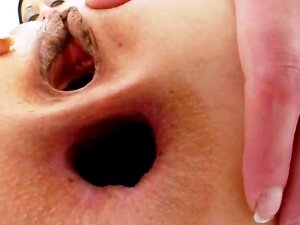Photo Anus Dilaté - Porno @ RueNu.com